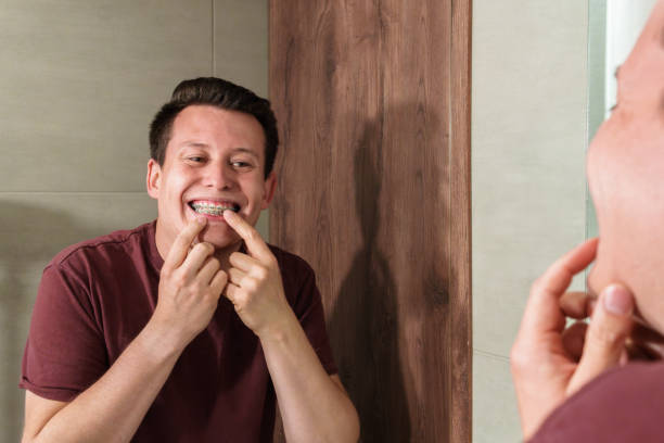 istock Young Man Smiling While Checking His Braces in the Mirror 2199506102