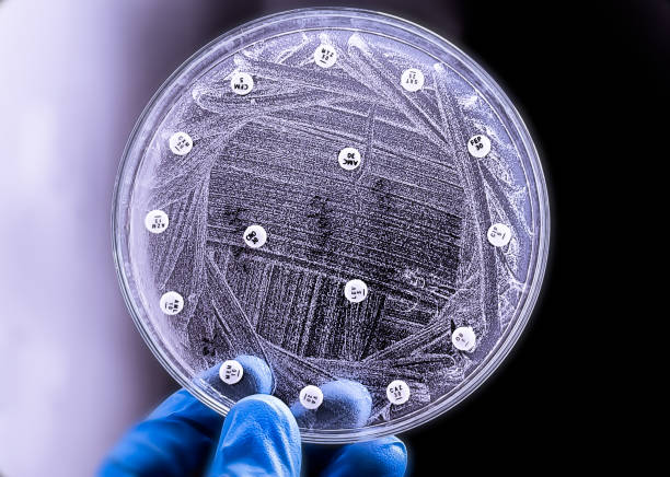 istock Microbiologist holding petri dish for antibiotic susceptibility testing of Candida spp. 2199609187