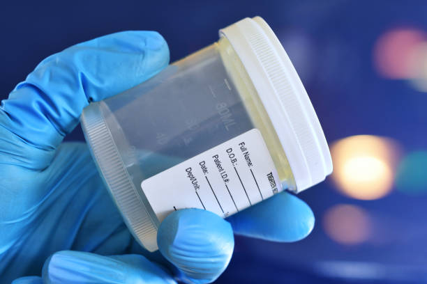 istock Specimen cup for urine or semen  sample to be tested 2199619674