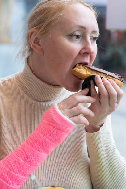istock woman with pink bandage on her right hand sits in cafe, bites chocolate eclair and drinks tea, leads active lifestyle despite restrictions 2200090795