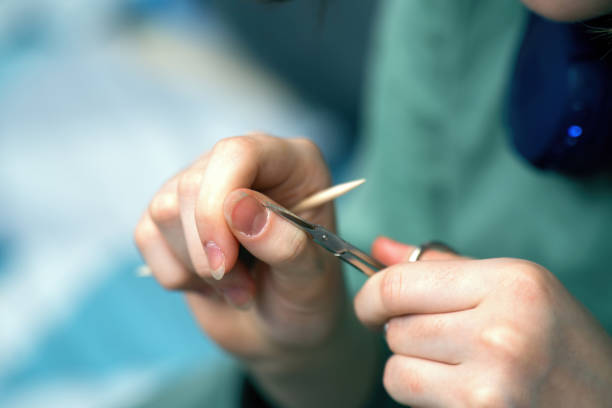 Closeup of deformed nails and torn, ripped and picked on cuticle skin peeling off from human nail biting behavior. Medical and healthcare concept, onychophagy, anxiety, stress, bad habits, mental health