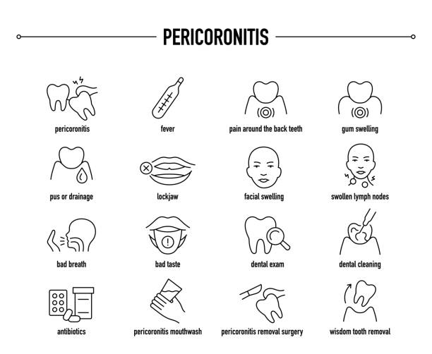 Pericoronitis symptoms, diagnostic and treatment vector icon set Pericoronitis vector icon set. Line editable medical icons. gingivoplasty stock illustrations