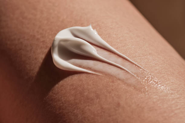White body cream on dry human skin.