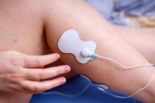 istock hands attaching an electrode from an electrical muscle stimulator to a leg, demonstrating the application of EMS technology for muscle training and rehabilitation 2201522772