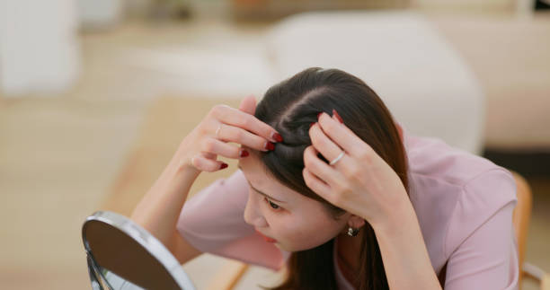 istock Asian woman worry hair loss 2201739435