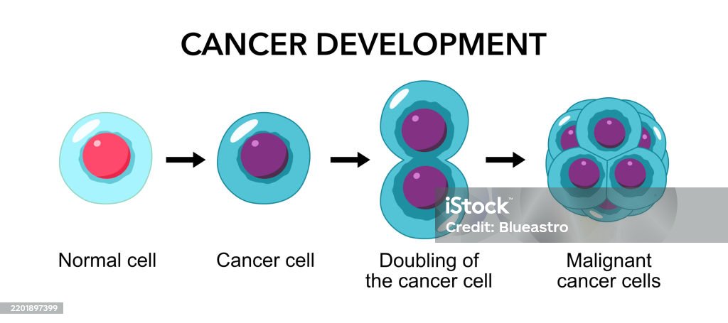 Cancer Development Published Cancer Development Normal Cells Are Transformed Into Cancer ...