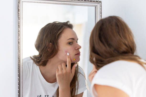 istock A young woman examines her acne in the mirror 2201954770