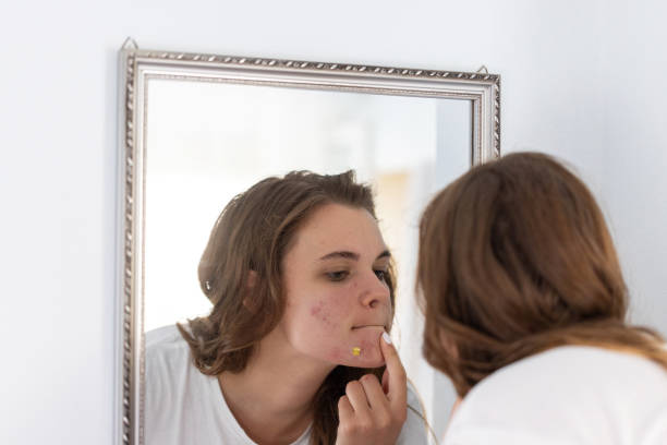 istock Young woman looking at her acne in the mirror 2201954773