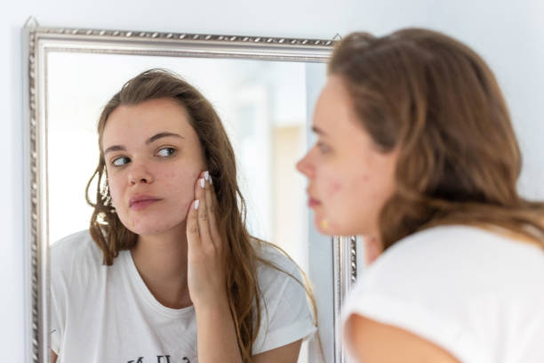 istock Young woman looking at her acne in the mirror 2201954849