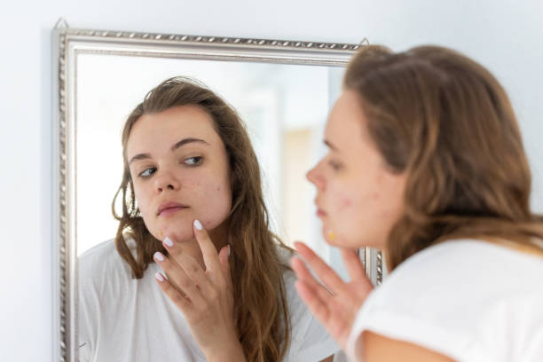 istock A reflective young woman studies her acne in the mirror 2201954969