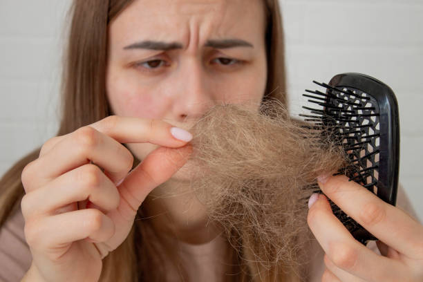 istock Concerned Woman with Hair Loss and Supplements Selective Focus 2202067099