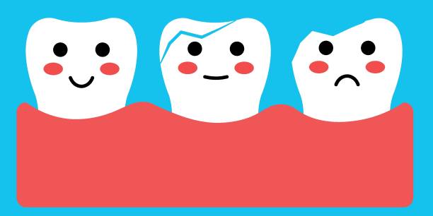 Cartoon Illustration Displaying Healthy, Cracked, and Chipped Teeth in Vibrant Colors An artistic cartoon illustration featuring a cheerful healthy tooth, a cracked tooth, and a chipped tooth over a brightly colored background, emphasizing dental care and oral health awareness. cute cartoon dental implants stock illustrations