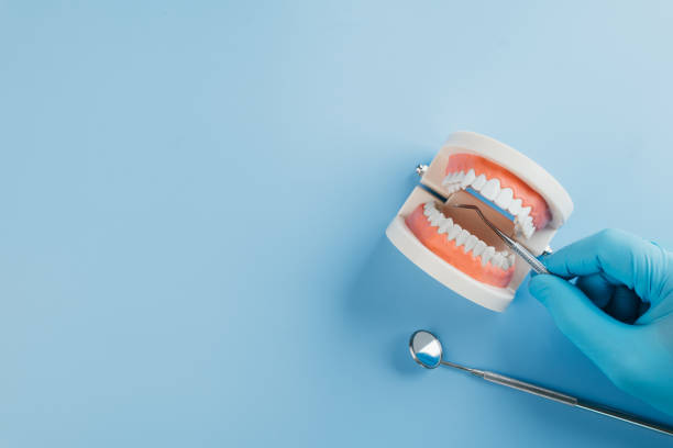 istock Dentist Day features a dentist gloved hand holding a probe and mirror to check a tooth model 2202200915