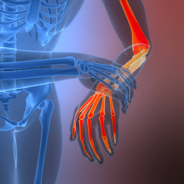 istock Human Suffering with Severe pain in Wrist Bone Joint Anatomy 2202279382