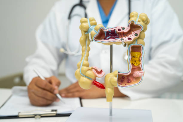 istock Intestine, appendix and digestive system, doctor holding anatomy model for study diagnosis and treatment in hospital. 2202454588