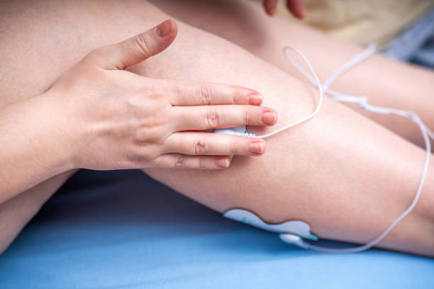 istock hands attaching an electrode from an electrical muscle stimulator to a leg, demonstrating the application of EMS technology for muscle training and rehabilitation 2202934236
