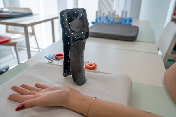 Hand splint application by a professional therapist in a modern physiotherapy center.
