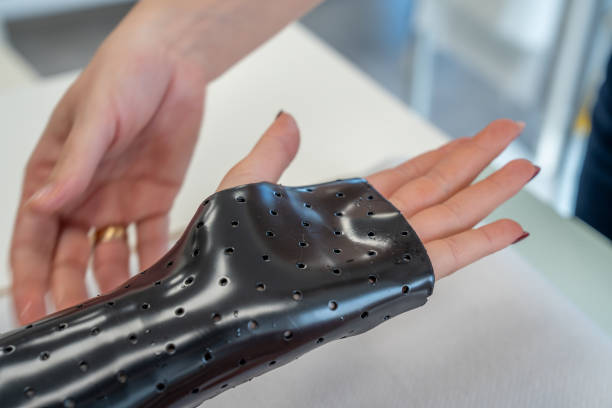 Hand splint application by a professional therapist in a modern physiotherapy center.
