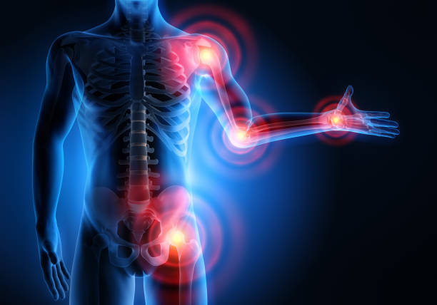 istock Pain in all joints-conceptual artwork-3d Illustration 2203084355