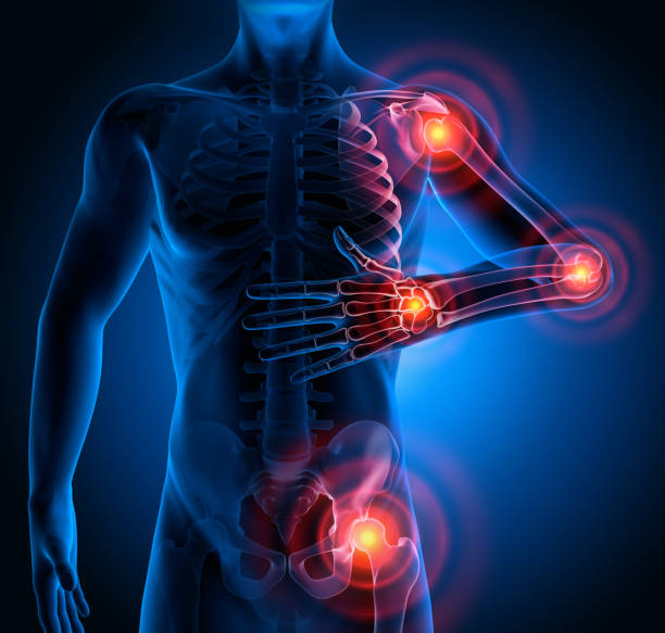 istock Pain in all joints-conceptual artwork-3d Illustration 2203084434