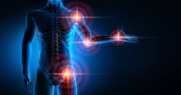 istock Pain in all joints-conceptual artwork-3d Illustration 2203084503