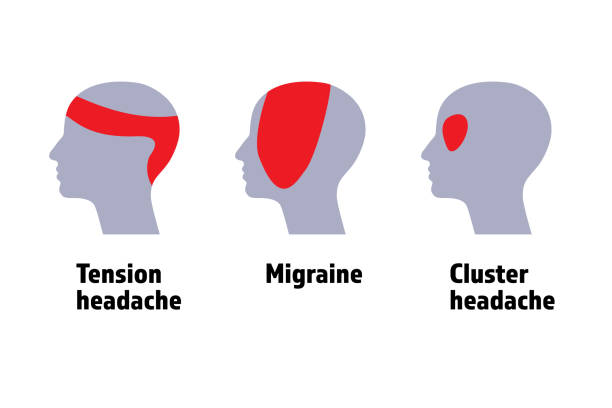 istock Common types of headache, migraine, tension headache and cluster headache. 2203192301