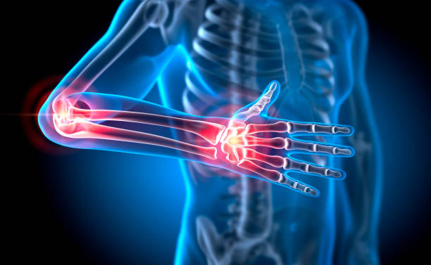 istock Pain in different joints - conceptual artwork - 3d Illustration 2203196494