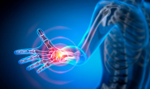 istock Pain in different joints - conceptual artwork - 3d Illustration 2203196497