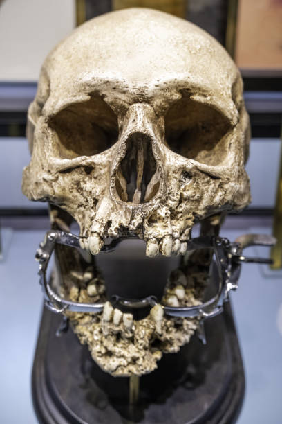 istock Human skull with dental prosthesis 2203212083