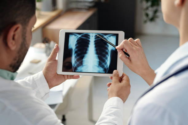 istock Close Up of Two Doctors Examining Chest X-Ray 2203229470