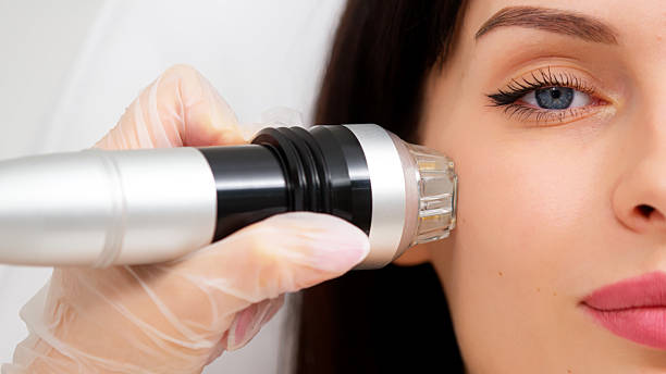 istock A woman undergoes cosmetic procedures using a bbl laser. 2203244972