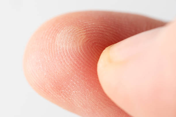 istock Injured with blister human finger 2203621826