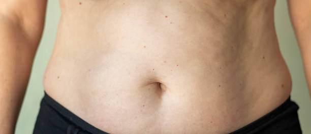 istock Close-up of a human midsection emphasizing natural skin and texture 2203667718