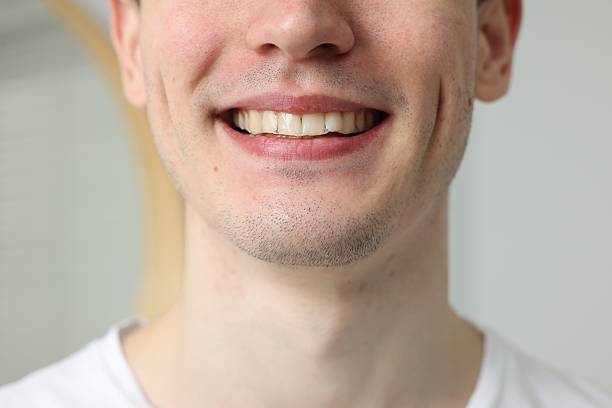 istock Young man using whitening strip on blurred background, closeup 2203910505