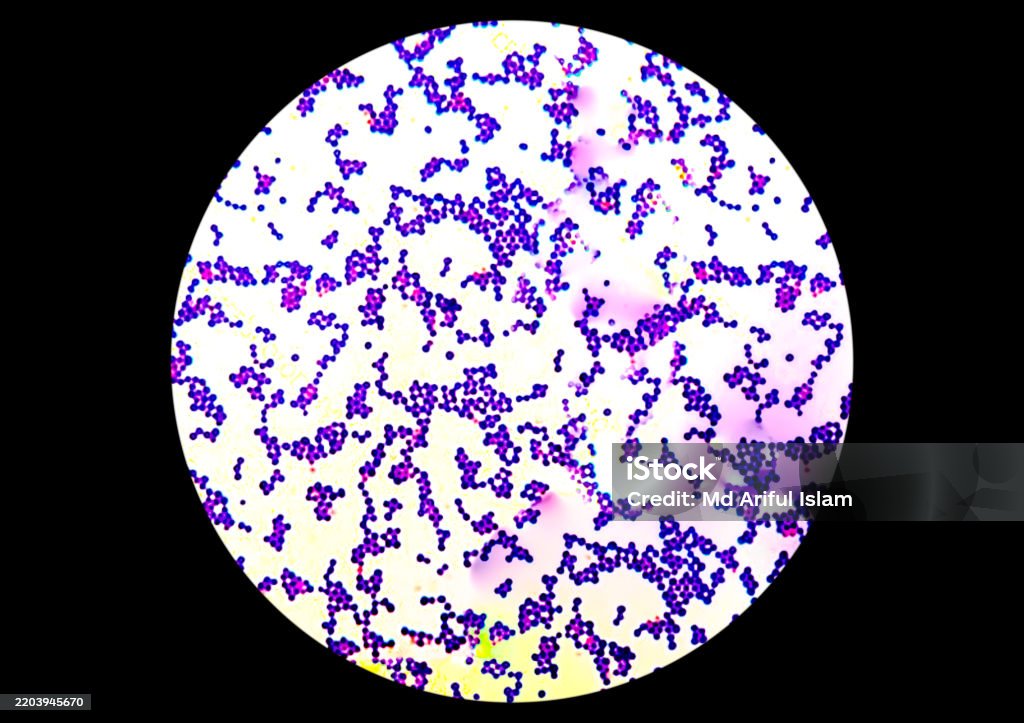 Staphylococcus Example Gram Positive Staphylococcus Appears In Cluster Form Under The ...