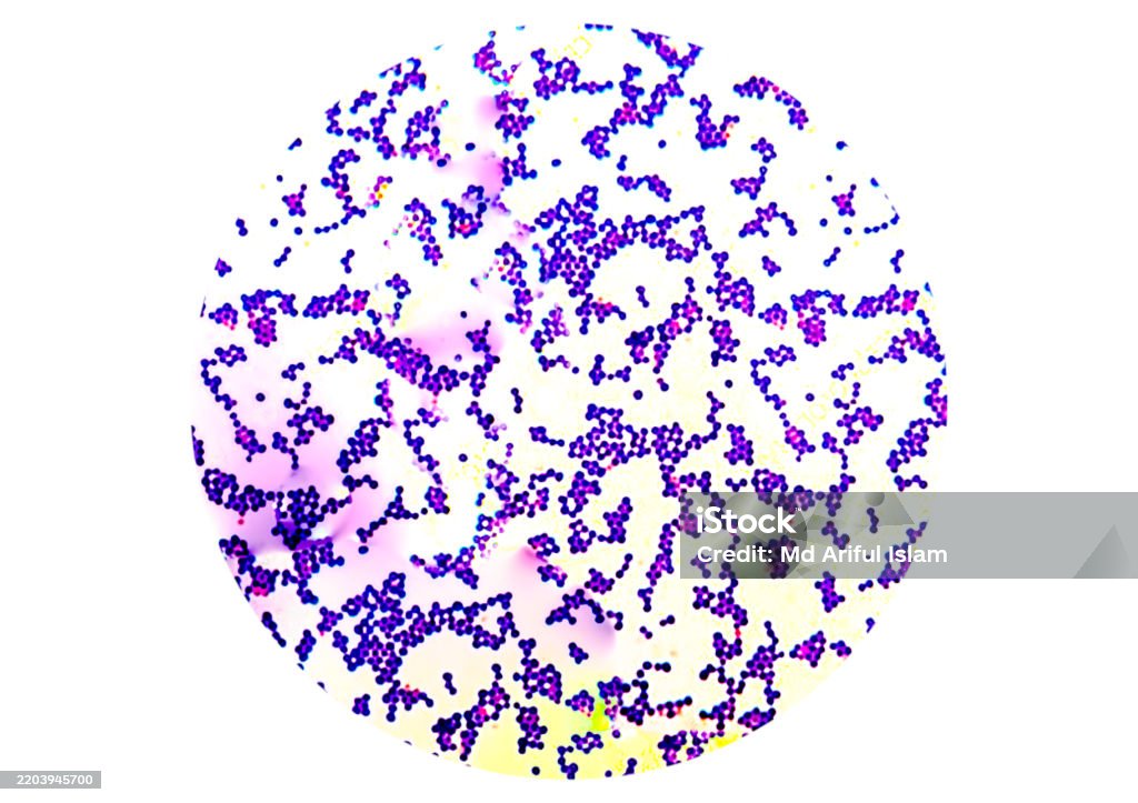 Staphylococcus Example Gram Positive Staphylococcus Appears In Cluster Form Under The ...