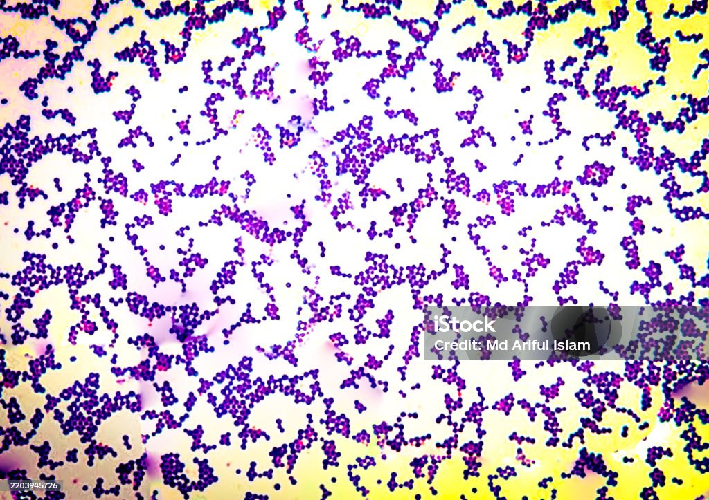 Staphylococcus Example Gram Positive Staphylococcus Appears In Cluster Form Under The ...
