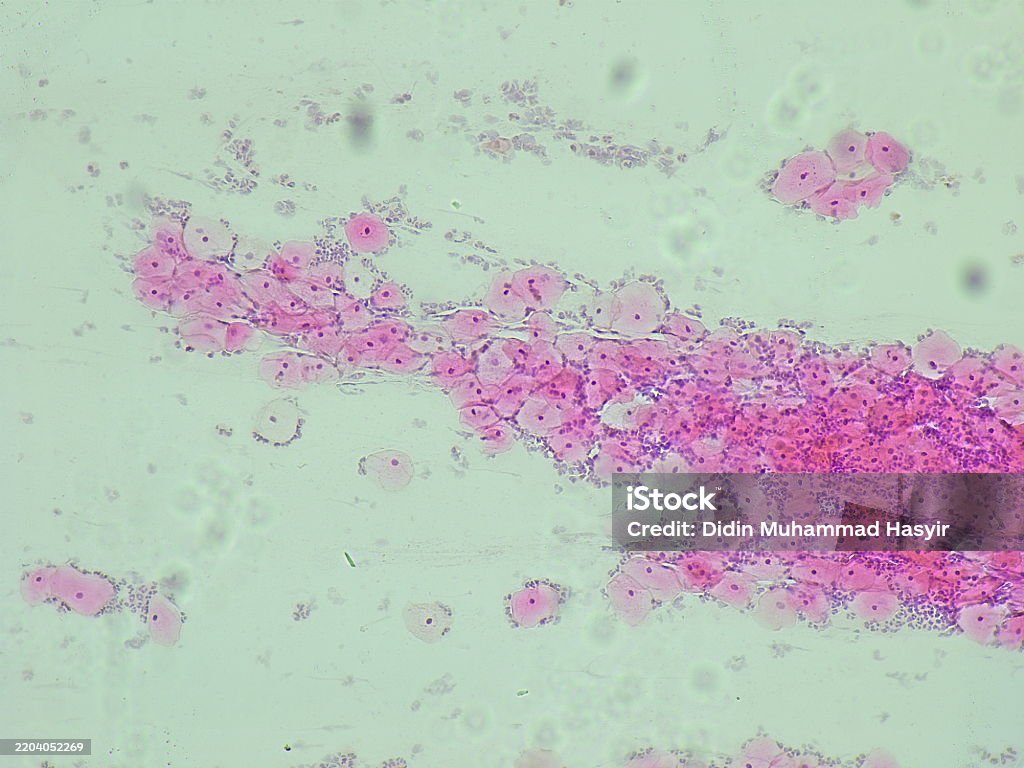Nilm Rear Pad Pap Smear Nilm Under A Microscope View For Education Histology Human ...