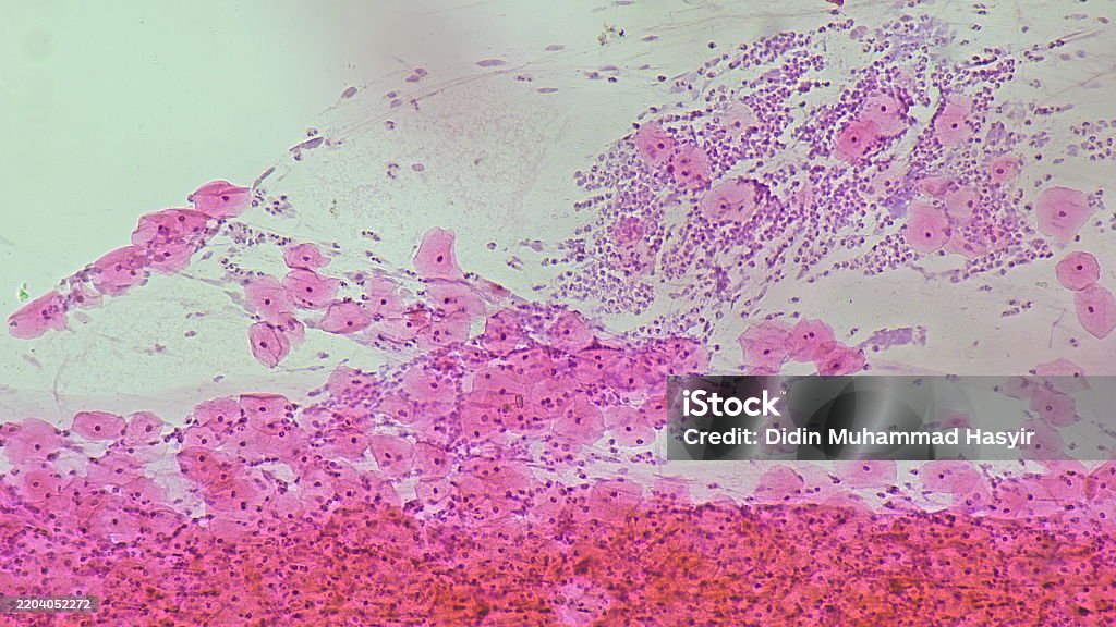 Nilm Rear Pad Pap Smear Nilm Under A Microscope View For Education Histology Human ...
