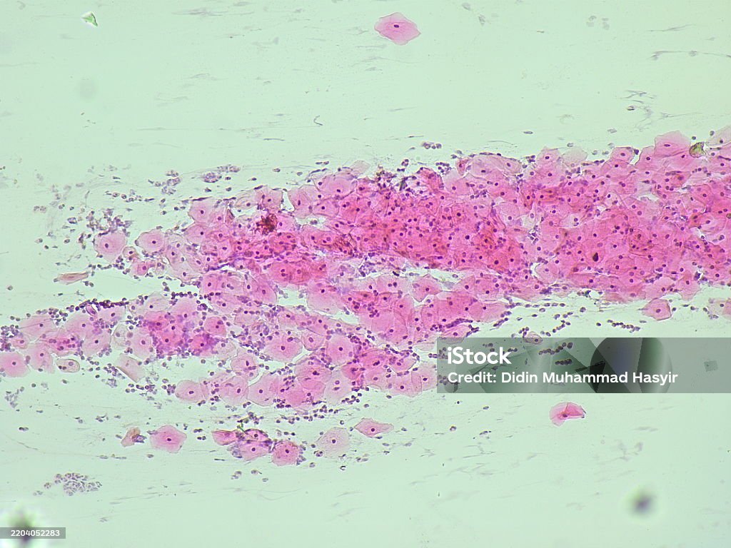 Nilm Rear Pad Pap Smear Nilm Under A Microscope View For Education Histology Human ...