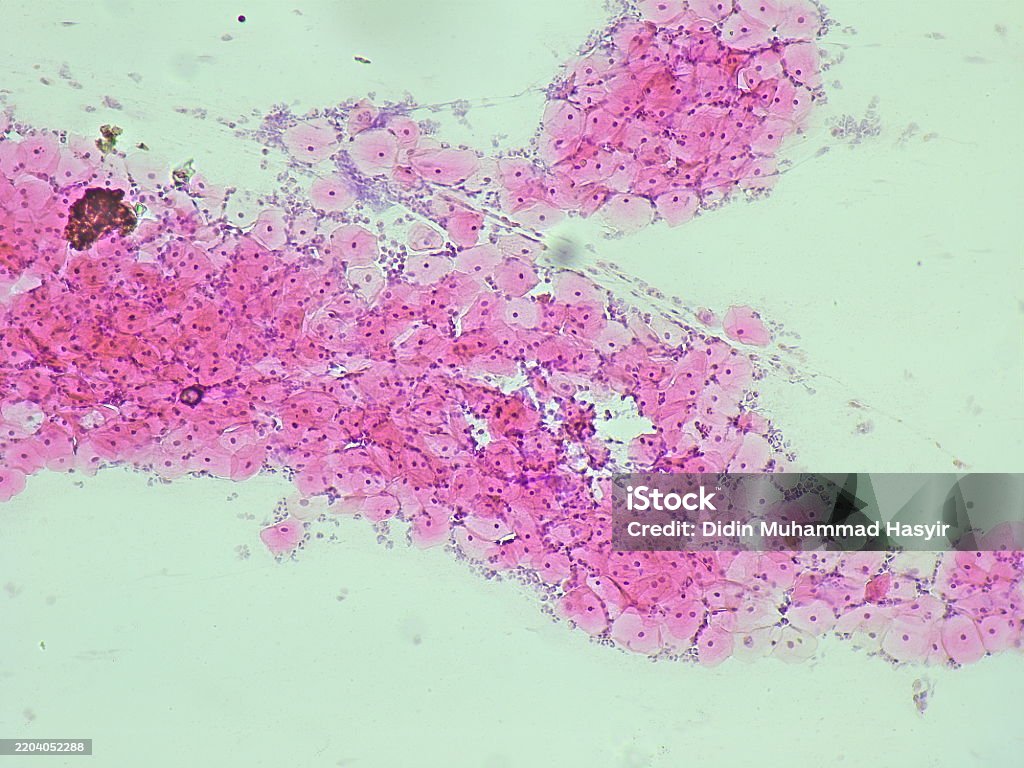 Nilm Rear Pad Pap Smear Nilm Under A Microscope View For Education Histology Human ...