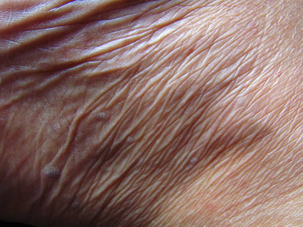 istock human skin wrinkles close photo 2204110793