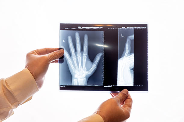 Doctor's hand in glove holds film of radiography. X-ray of a patient