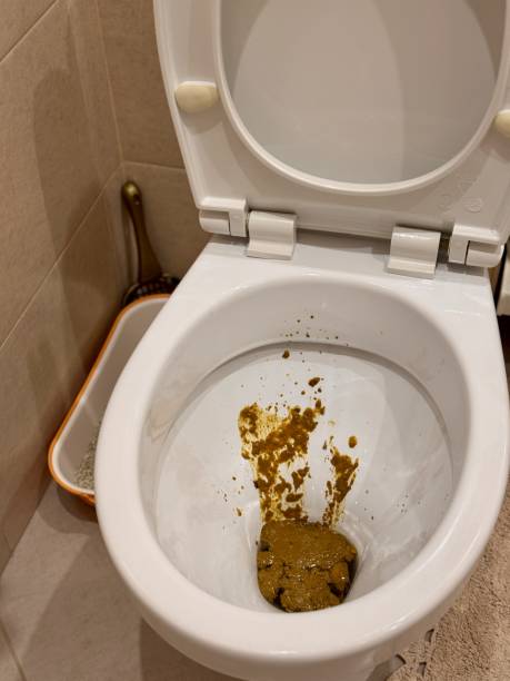 istock Liquid diarrhea after eating in poor nutrition establishments. An extremely dirty and unsanitary toilet with unwashed contents, which creates serious hygiene problems 2204578829