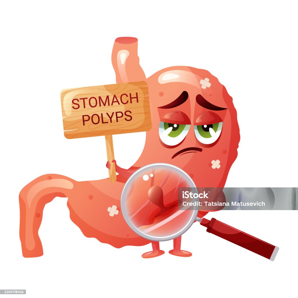 Polypectomy Cartoon Polyp In Stomach Under Magnification Funny Sad Cartoon Stomach Vector ...