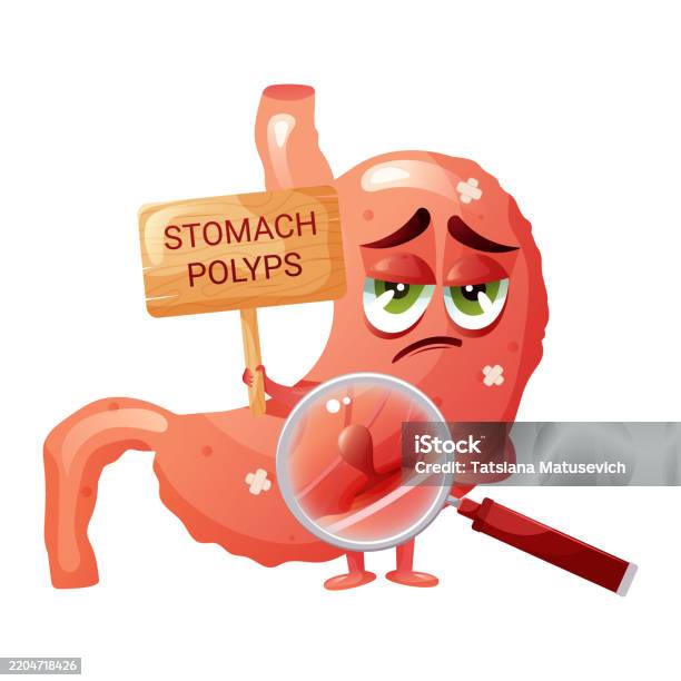 Polypectomy Image Cartoon Polyp In Stomach Under Magnification Funny Sad Cartoon Stomach Vector ...