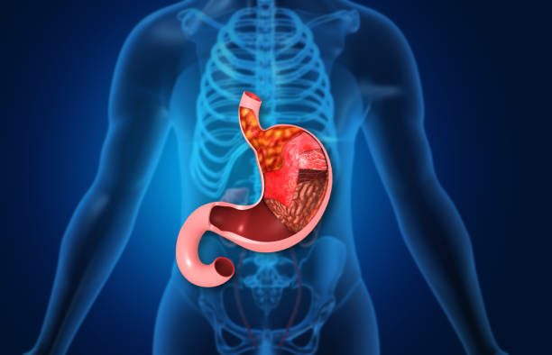 istock Human stomach anatomy with human body 2204863329