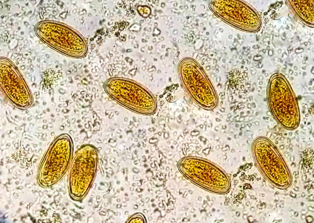 Enterobius vermicularis (EV) eggs. parasite in stool, image under light microscopy 100X objective. Enterobius vermicularis (EV) eggs. parasite in stool, image under light microscopy 100X objective. Scientific micrograph of parasite. parasite egg stock pictures, royalty-free photos & images