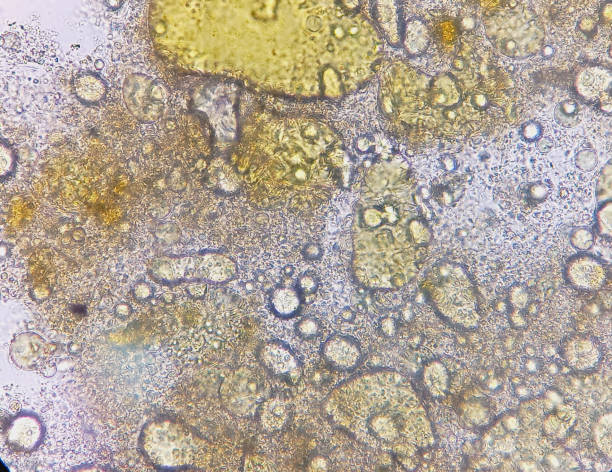 istock Microscopic image of stool Fat Globules cells. 2205150054