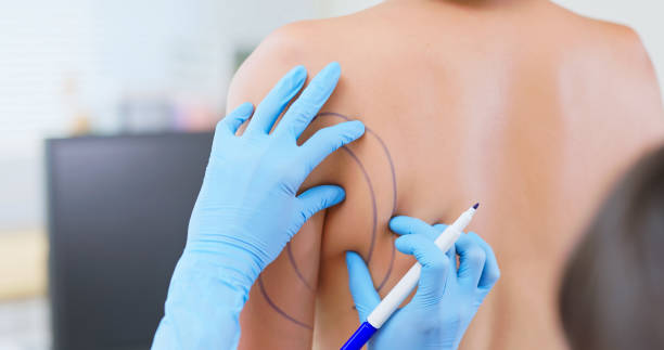 istock woman plastic surgeon preparation 2205168322